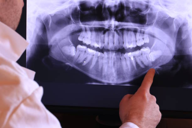 Best Emergency Root Canal Treatment in Bixby, OK