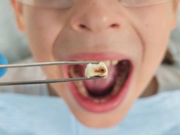 Best Emergency Dental Surgery in Bixby, OK